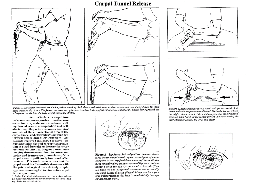 Carpal Tunnel Exercises Printable  